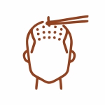 Hair Transplant Correction
