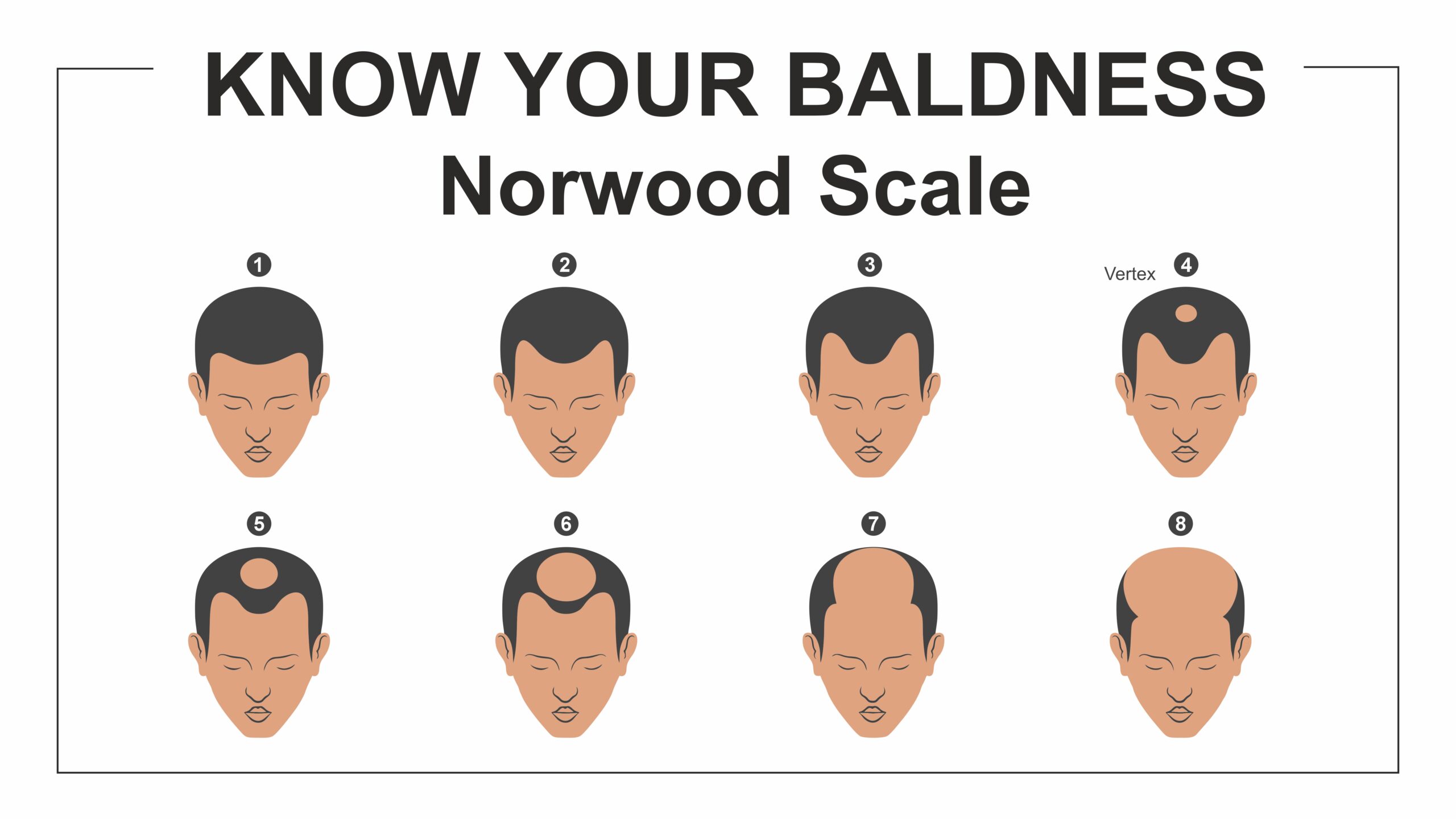 best hair transplant clinic in Haridwar