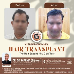 Beige Aesthetic beauty care Before After Treatment Instagram Post.jpg