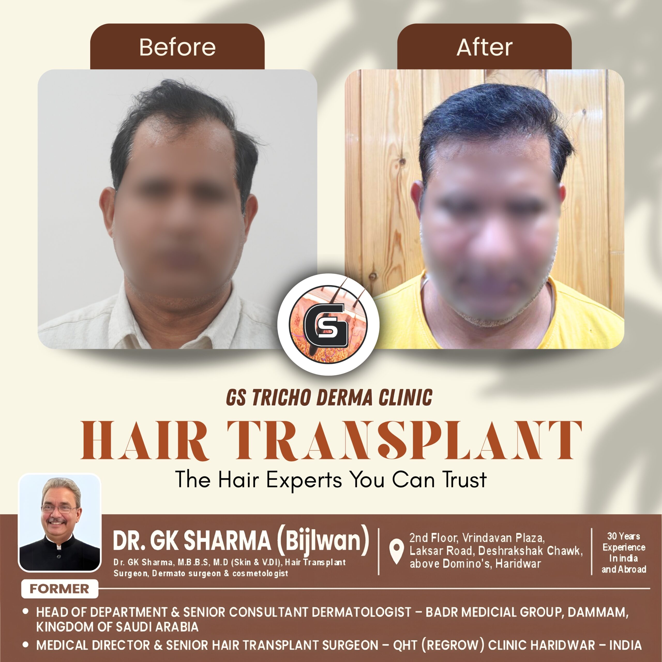 Beige Aesthetic beauty care Before After Treatment Instagram Post.jpg