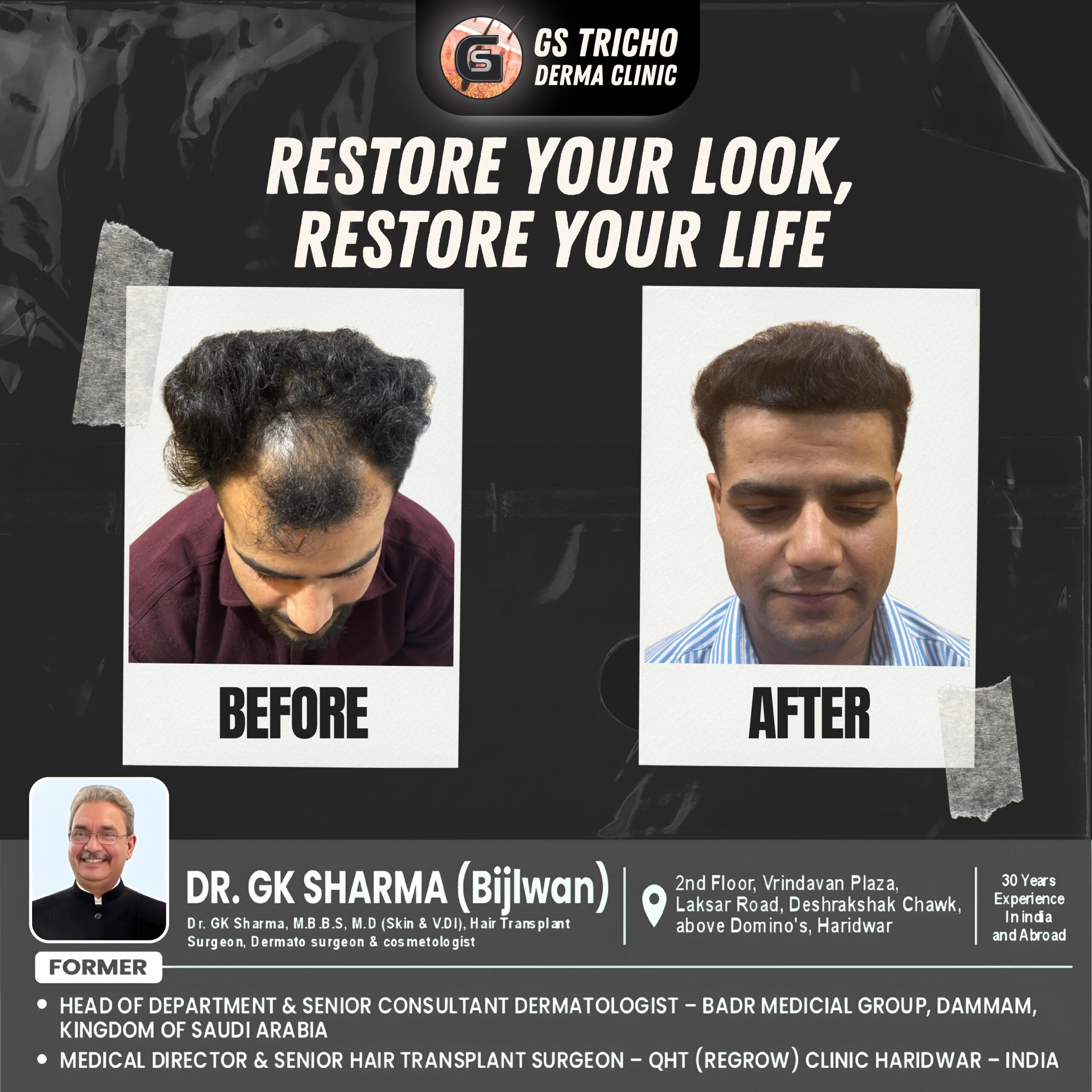 Black White Modern New Case Before After Instagram Post.jpg