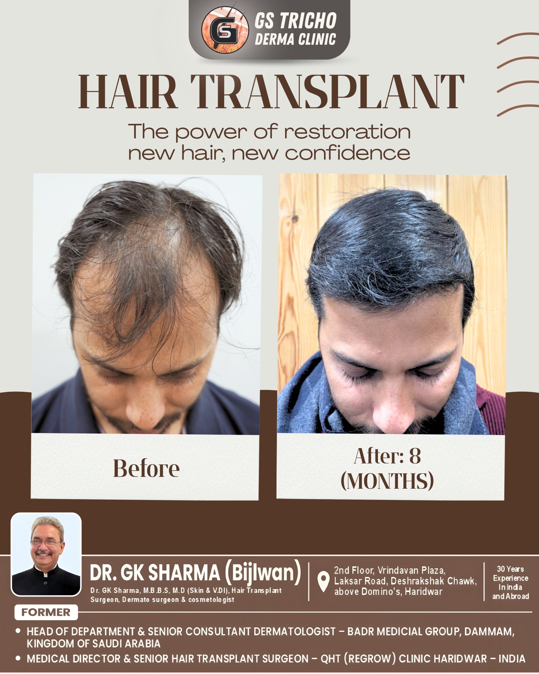 HAIR TRANSPLANT.jpg