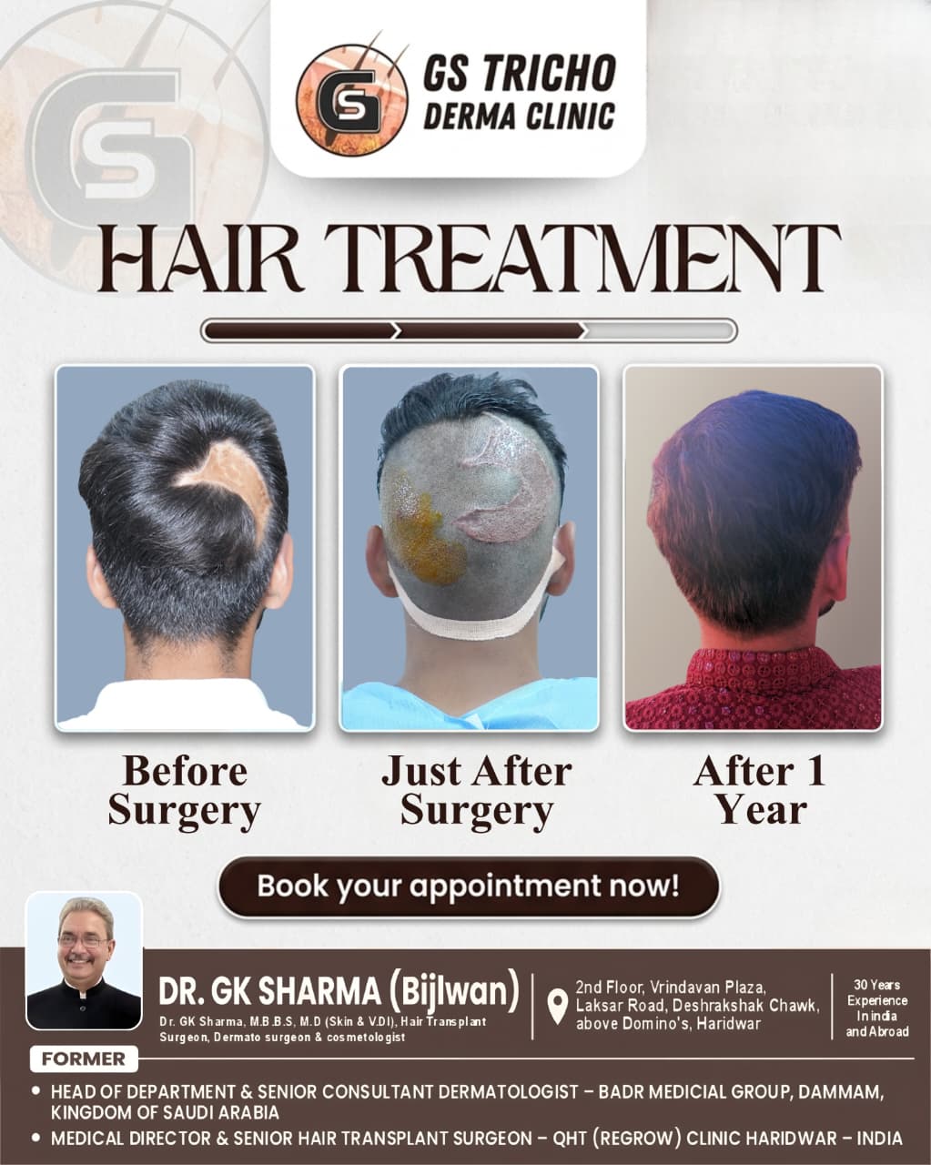 Hair transplant in Haridwar