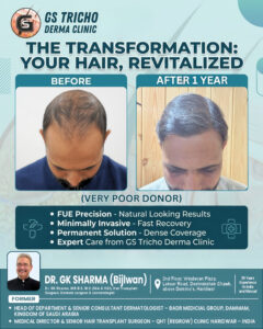 after 8 (months).jpg