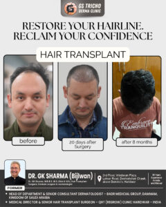 hair transplant (2).jpg
