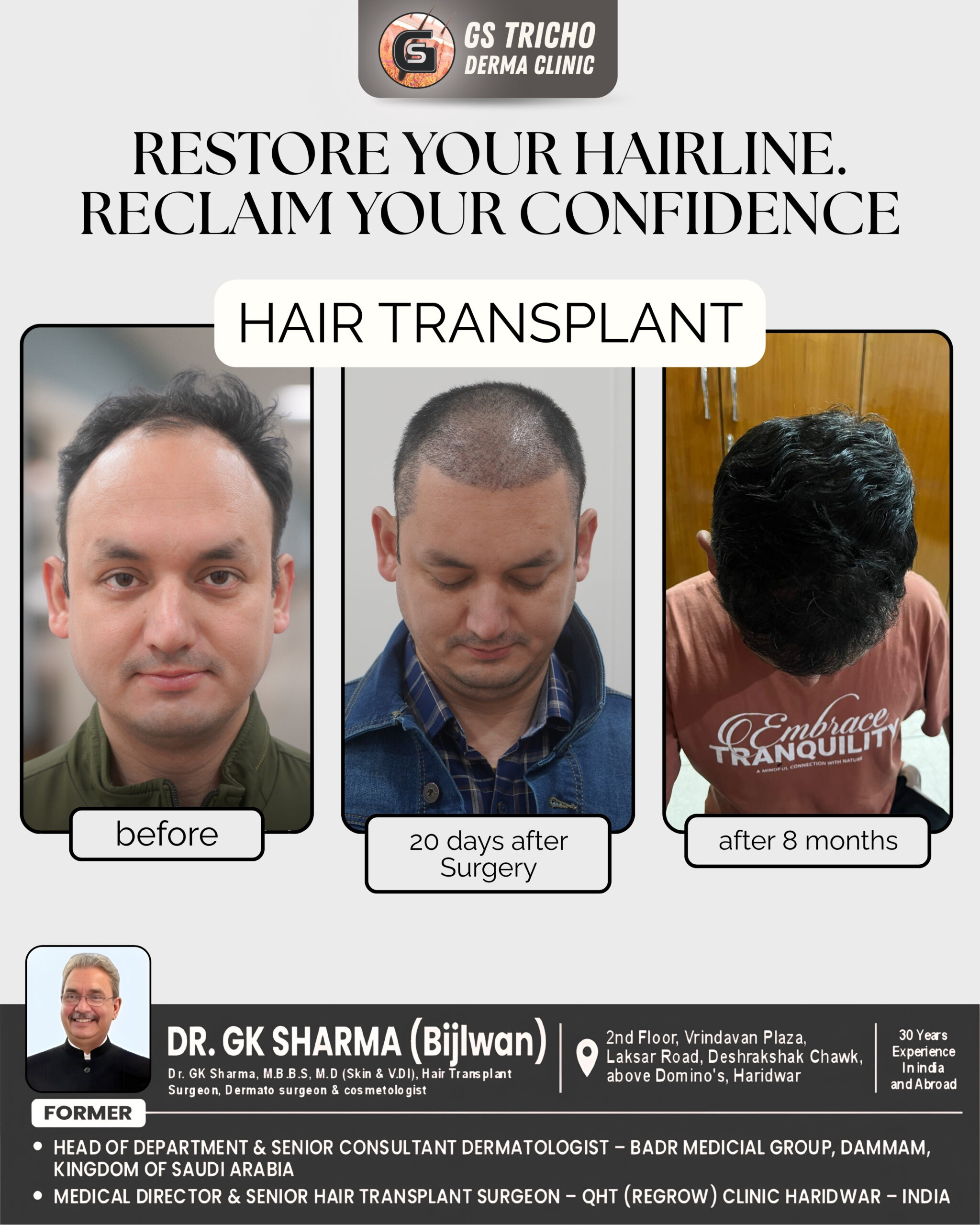 hair transplant (2).jpg